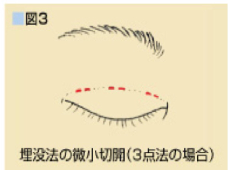 abt_img1
