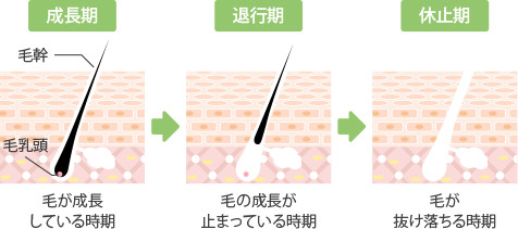 脱毛図解