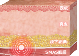 医療ハイフ 図解