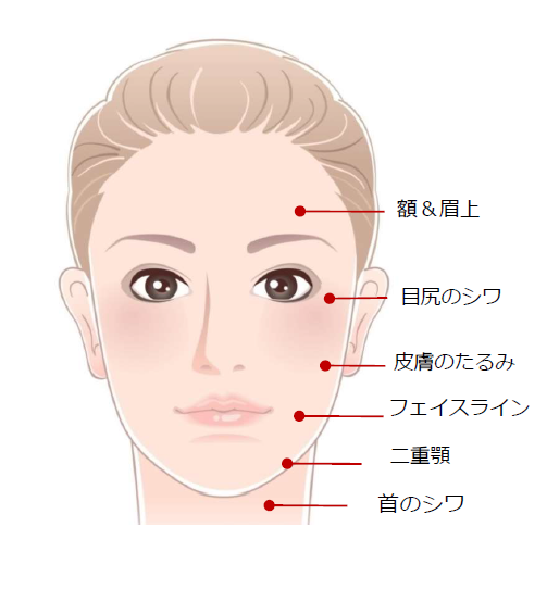 医療ハイフでシワたるみ改善 千里中央スキンクリニック 皮膚科美容皮膚科 旧称千里中央ゆみスキンクリニック
